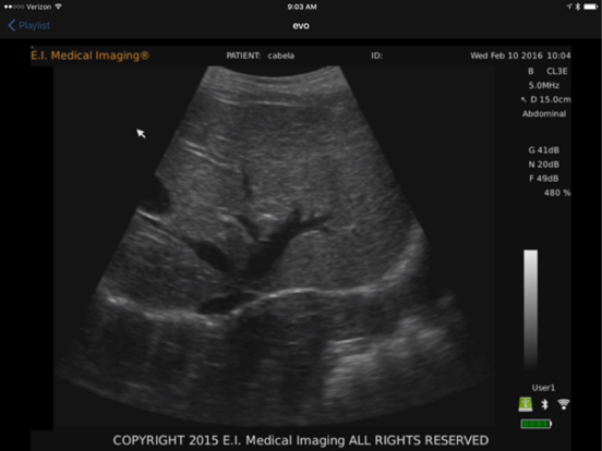 Screenshot #4 pour E.I. Medical Imaging