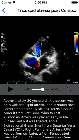 CARDIO3® Comprehensive Atlas of Echocardiography - Liteのおすすめ画像4