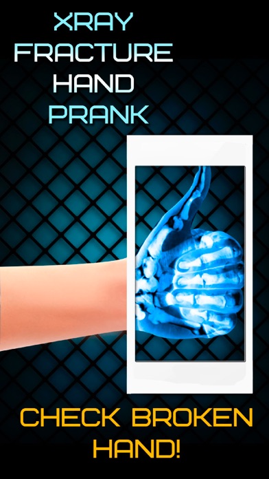 Screenshot #3 pour Xray Fracture Hand Prank