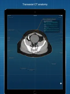X-Anatomy Basic iPad image 1
