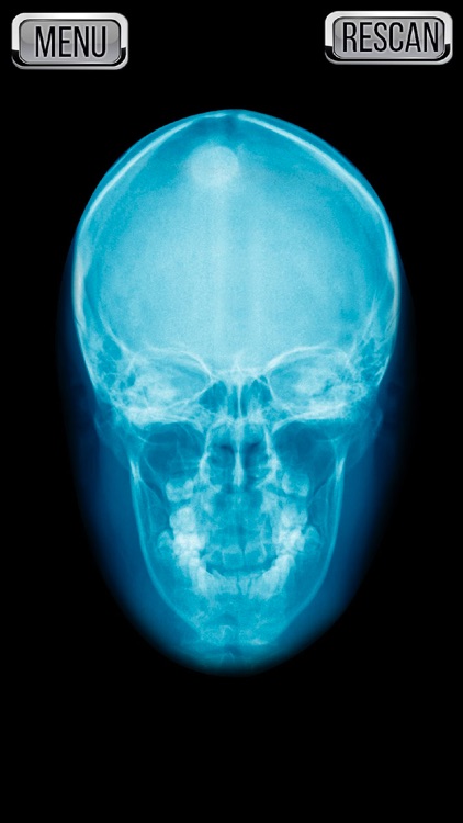 Xray Scanner Head Prank