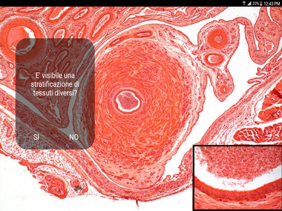 Screenshot #5 pour Diagnosi di Anatomia Microscopica