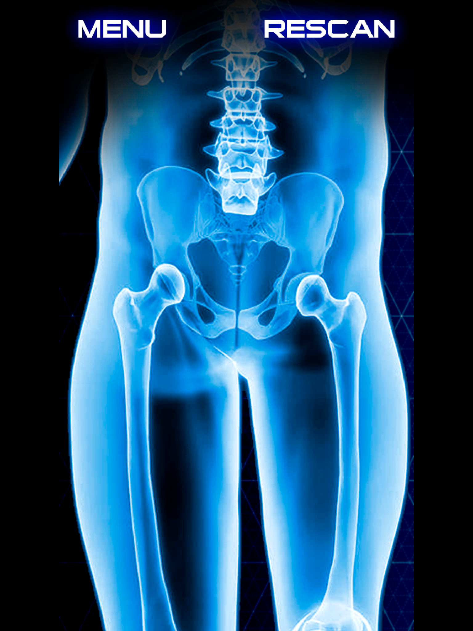 Xray Scanner Hip Bone Prank