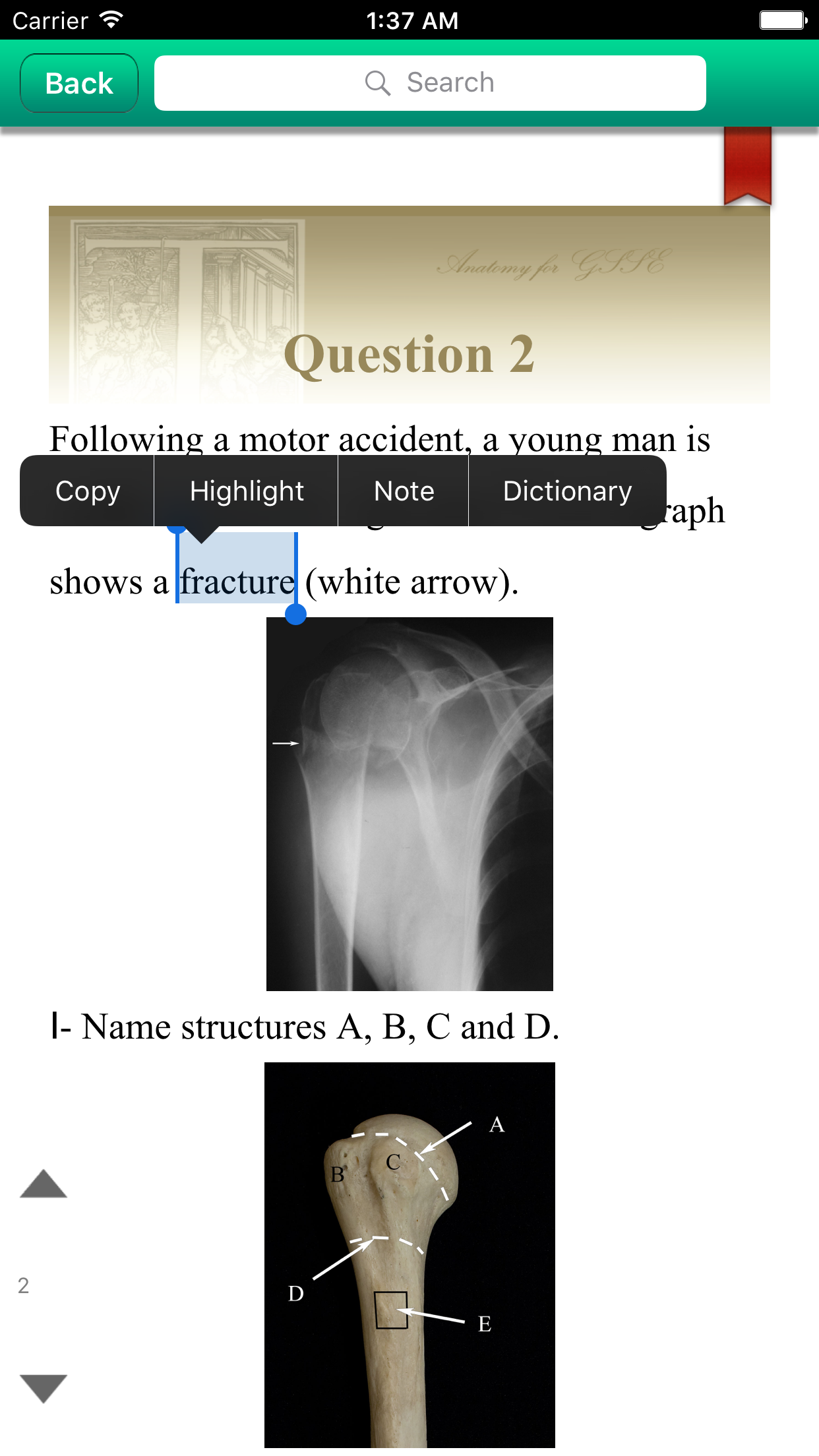 Anatomy For GSSE  for iPhone screenshot 2