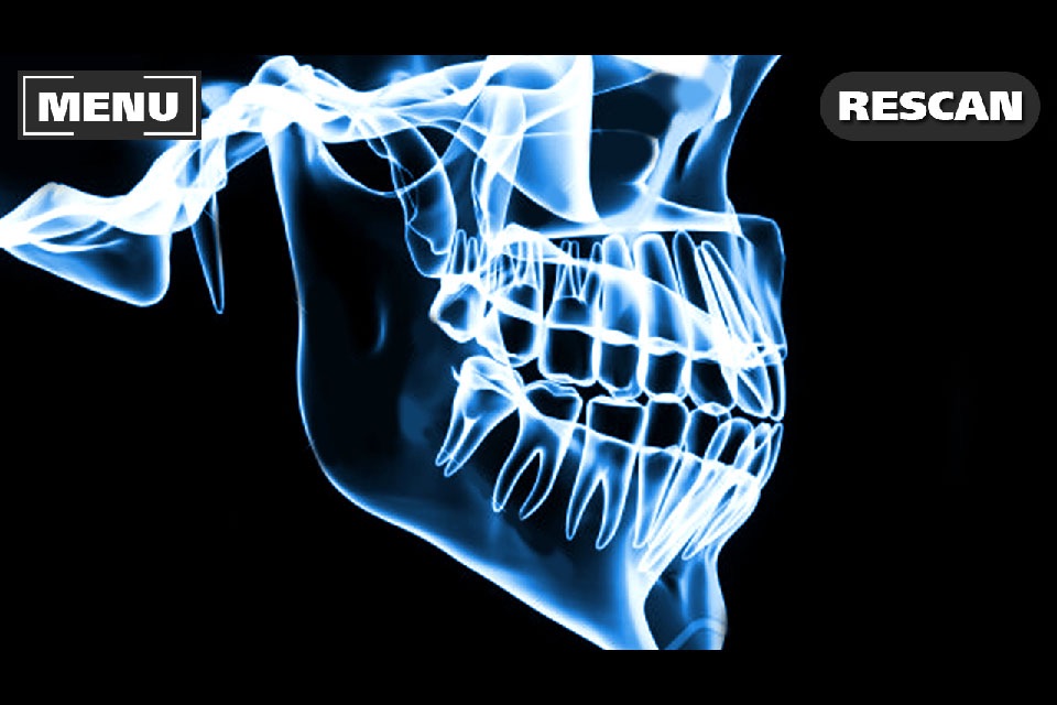 Xray Scanner Teeth Prank screenshot 2