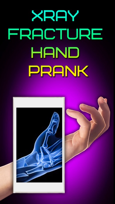Screenshot #1 pour Xray Fracture Hand Prank
