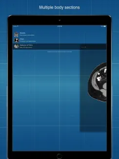 X-Anatomy Basic iPad image 4