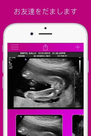 Ultrasound Prank Free - Pregnant Spoof And Fake Pregnancy Trick screenshot 3