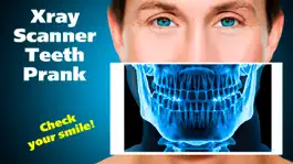 Game screenshot Xray Scanner Teeth Prank mod apk