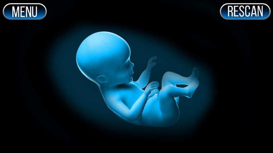 #2. Xray Scanner Pregnant Prank (iOS) 由: Stepan Ivanov