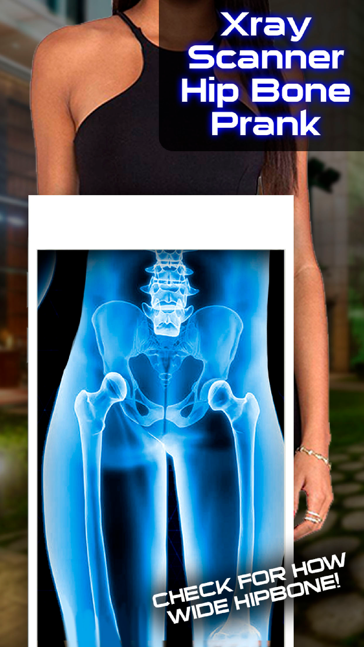 Xray Scanner Hip Bone Prank