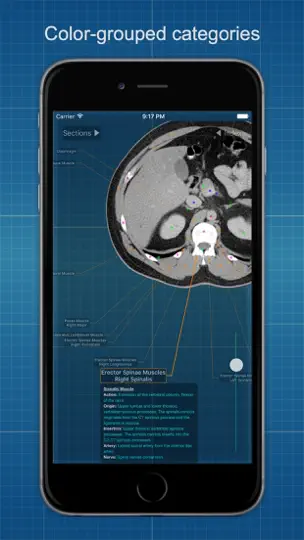 X-Anatomy Basic iPhone Screenshot 5