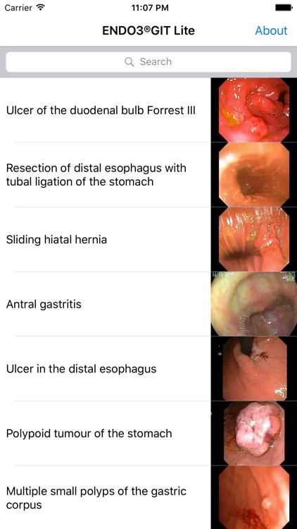 ENDO3® Atlas of Gastrointestinal Endoscopy - Lite
