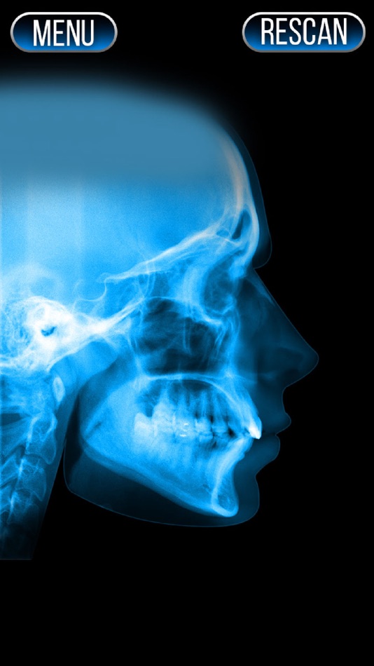 #2. Xray Scanner Nose Prank (iOS) Podle: Stepan Ivanov