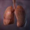 Living Lung
