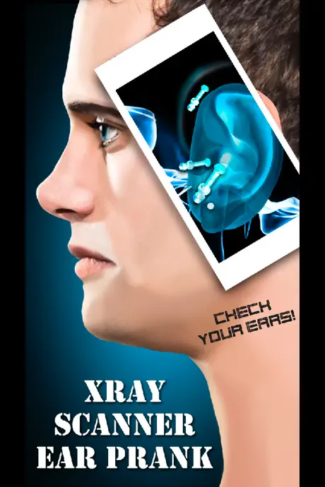 Xray Scanner Ear Prank