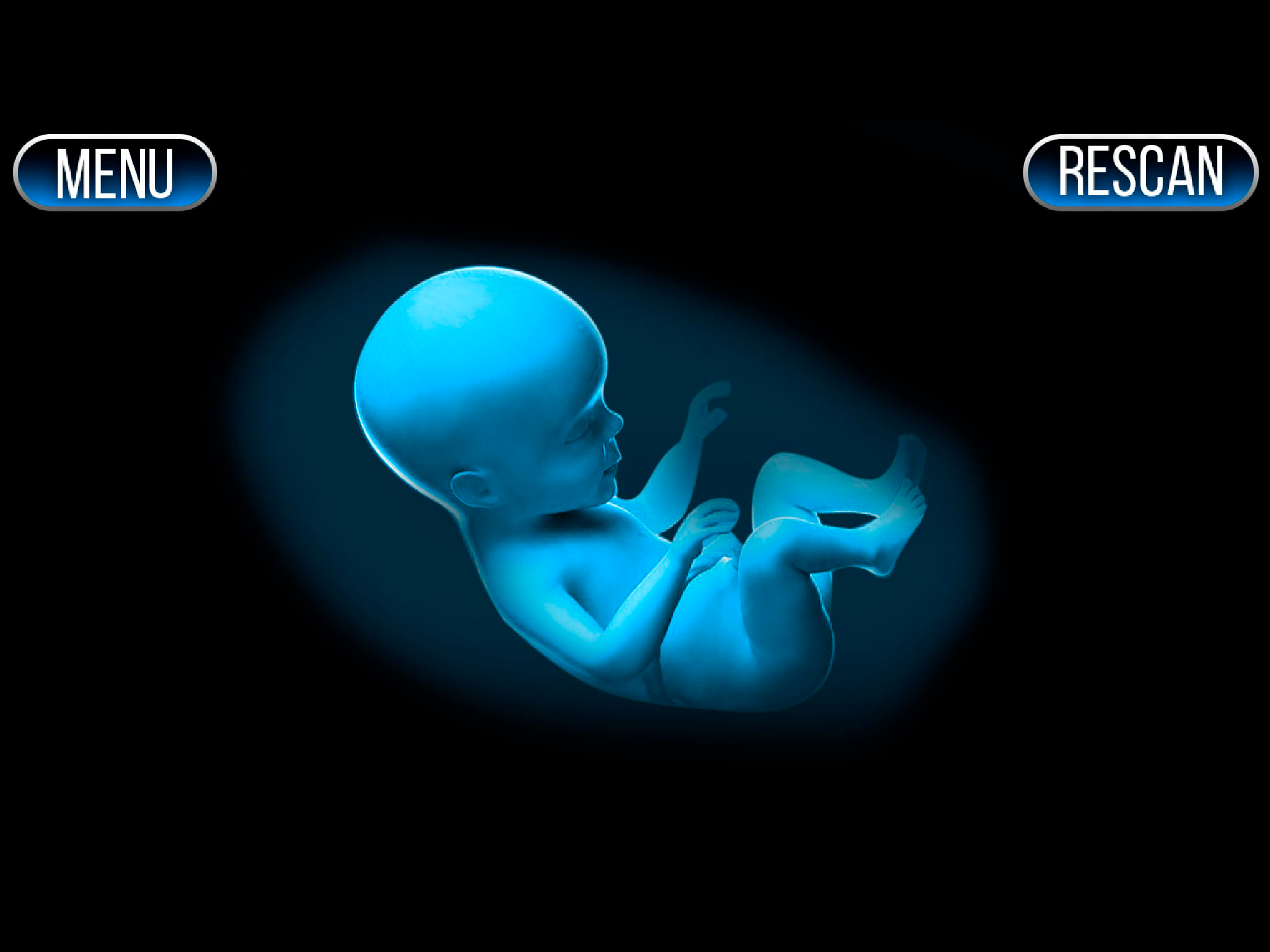 Xray Scanner Pregnant Prank