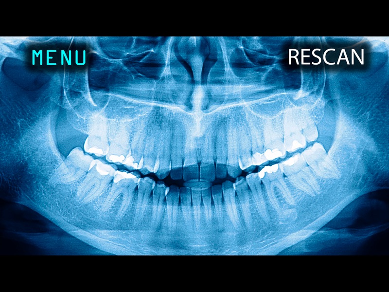 X-Ray Human Teeth Joke screenshot 5