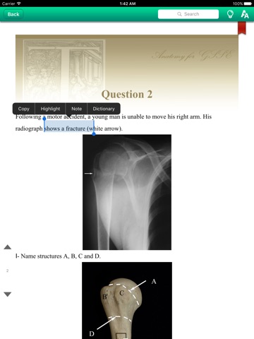 Anatomy For GSSE screenshot 3