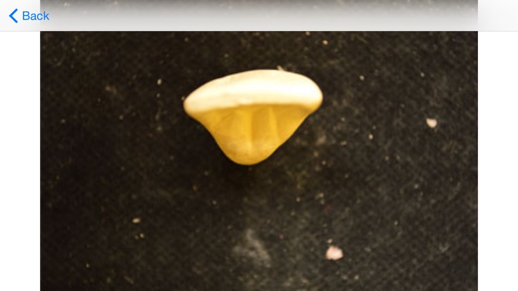Tooth Morphology - Your Quick Reference Guide screenshot-3