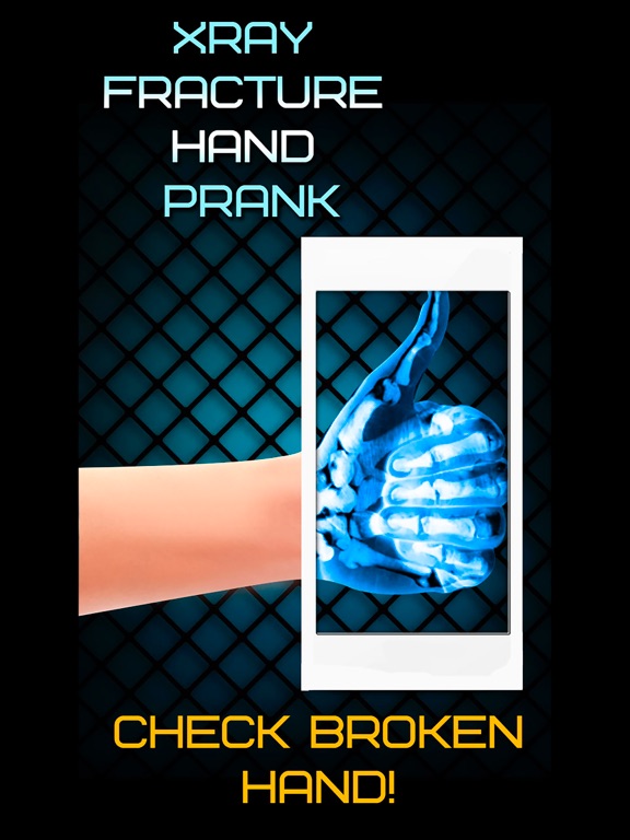 Screenshot #6 pour Xray Fracture Hand Prank