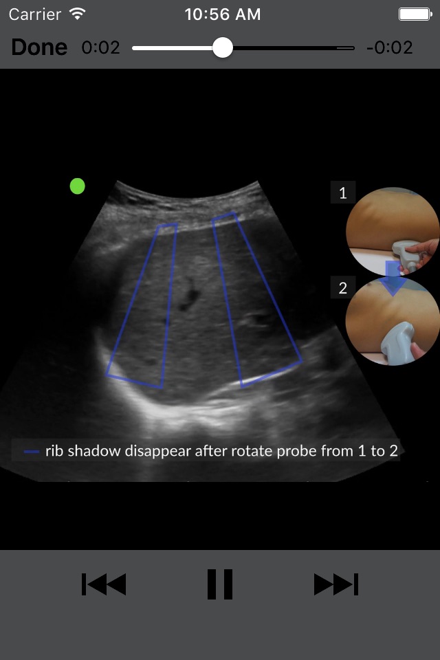 RESUS Ultrasound screenshot 3