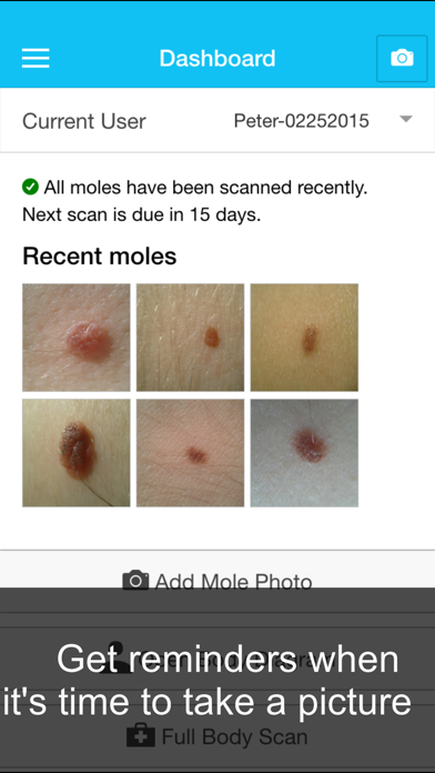 Skin Cancer App - MySkinPal - Map your skin moles Screenshot 4