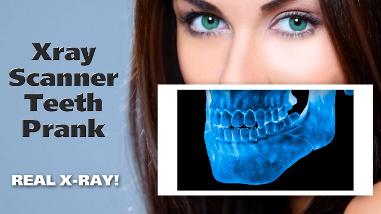 Xray Scanner Teeth Prank