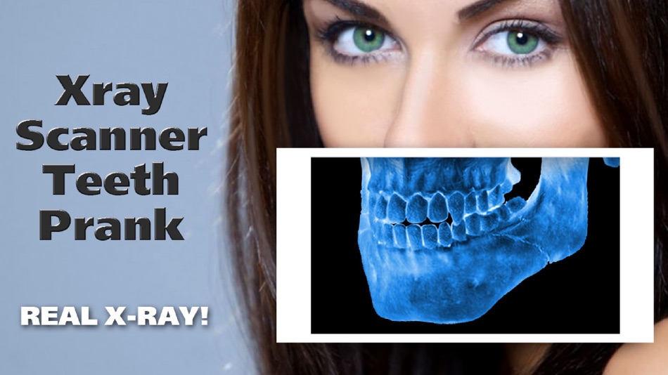 #3. Xray Scanner Teeth Prank (iOS) 由: Stepan Ivanov