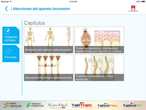 Screenshot #5 pour Mini Atlas Musculo Esquelético