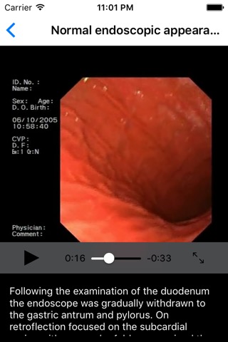 ENDO3® Atlas of Gastrointestinal Endoscopy - Liteのおすすめ画像4
