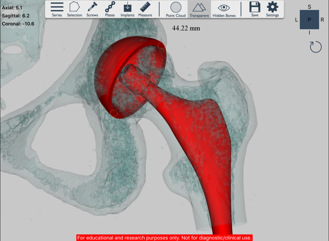 Ossa 3D(圖5)-速報App