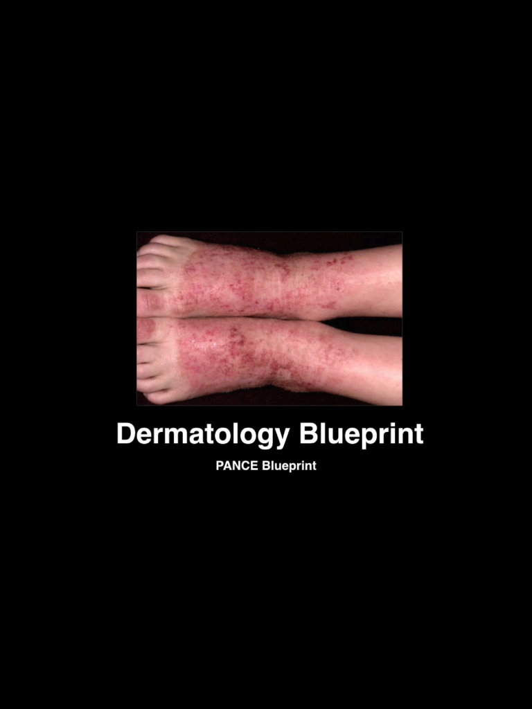Dermatology Blueprint PANCE & PANRE Review Course