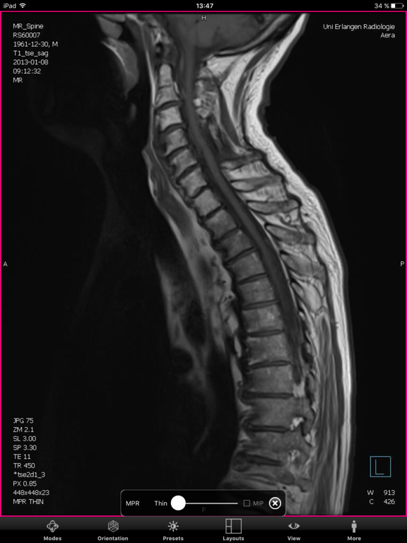 Screenshot #4 pour syngo®.via WebViewer