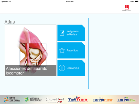 Screenshot #4 pour Mini Atlas Musculo Esquelético