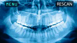 Game screenshot X-Ray Human Teeth Joke apk