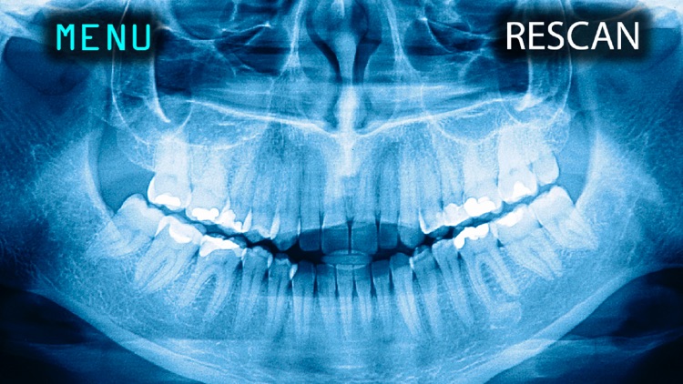 X-Ray Human Teeth Joke