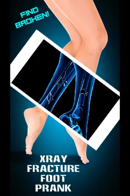 Game screenshot Xray Fracture Foot Prank hack