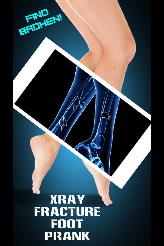 Xray Fracture Foot Prank screenshot 3