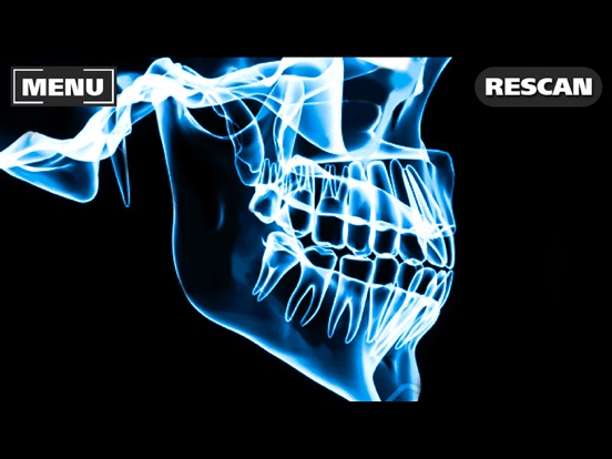 Screenshot #5 pour Xray Scanner Teeth Prank