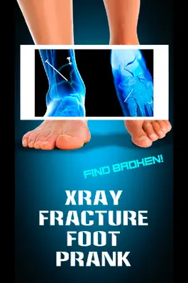 Game screenshot Xray Fracture Foot Prank mod apk