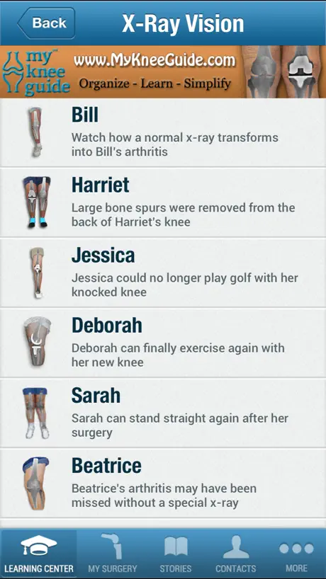 My Knee Guide