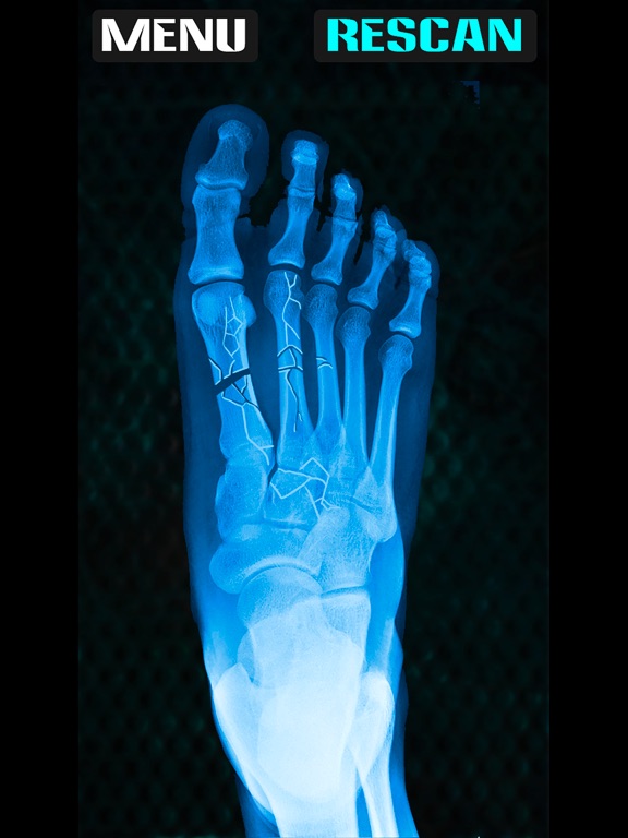 Screenshot #5 pour Xray Fracture Foot Prank