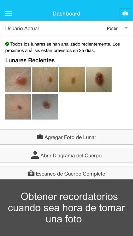 Cáncer De Piel - MySkinPal - Revisas tus lunares screenshot 4 of 5