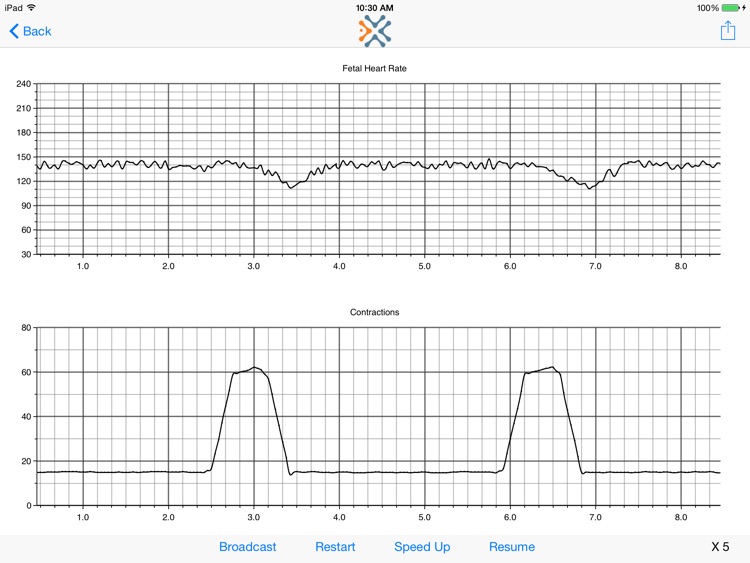 Simulated Electronic Fetal Monitor Lite screenshot-4