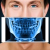 Xray Scanner Teeth Prank