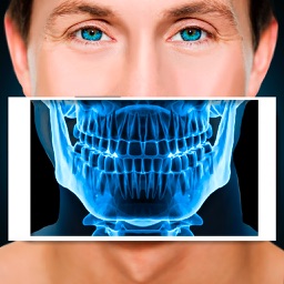 Xray Scanner Teeth Prank