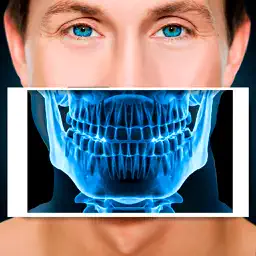 Xray Scanner Teeth Prank app icon