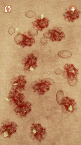 Game screenshot Pimples & Zits hack