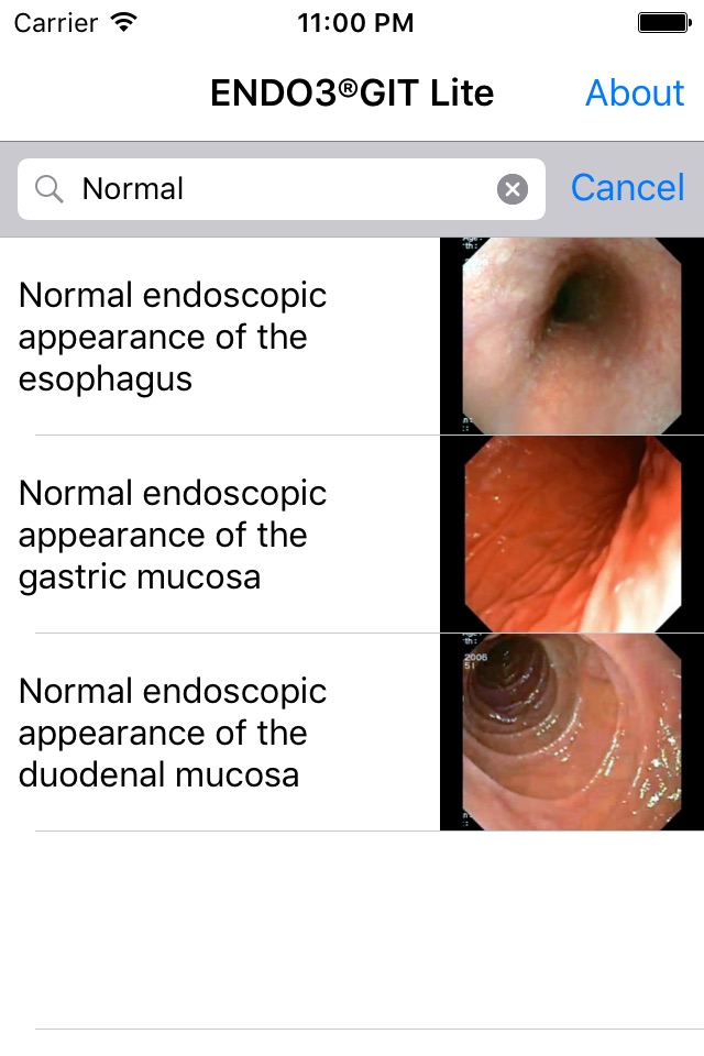 ENDO3® Atlas of Gastrointestinal Endoscopy - Lite screenshot 3